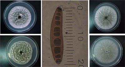 Bipolaris sorokiniana-Induced Black Point, Common Root Rot, and Spot Blotch Diseases of Wheat: A Review